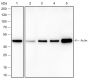 Anti-alpha Skeletal Muscle Actin Rabbit mAb