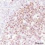 Anti-TCF3/E2A Rabbit mAb
