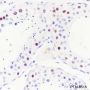 Anti-TCF3/E2A Rabbit mAb