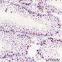 Anti-SUV39H2 Rabbit mAb
