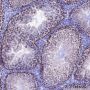 Anti-SUV39H2 Rabbit mAb