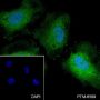 Anti-Thymidylate Synthase Rabbit mAb