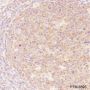 Anti-NF-kB2 p100/p52 Rabbit mAb