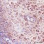 Anti-IL-1RA Rabbit mAb