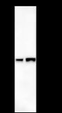 Anti-Calponin 1 Mouse mAb