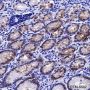 Anti-Claudin-18.2 Rabbit mAb