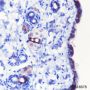Anti-Keratin 10 Rabbit mAb
