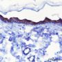 Anti-Keratin 10 Rabbit mAb