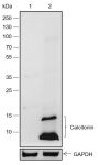 Anti-Calcitonin Rabbit pAb