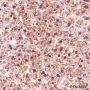 Anti-ADK Rabbit mAb