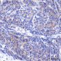 Anti-DR5 Rabbit mAb