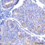 Anti-DR5 Rabbit mAb