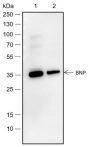 Anti-BNP Rabbit pAb