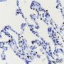 Anti-TTF1 Rabbit mAb