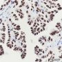 Anti-TTF1 Rabbit mAb