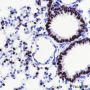 Anti-TTF1 Rabbit mAb
