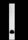 Anti-CGA / hCG alpha Rabbit pAb