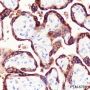 Anti-CGA / hCG alpha Rabbit pAb