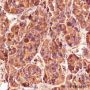 Anti-CGA / hCG alpha Rabbit pAb
