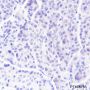 Anti-CGA / hCG alpha Rabbit pAb