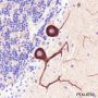 Anti-non-Muscle Myosin IIB / MYH10 Rabbit pAb