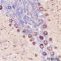 Anti-non-Muscle Myosin IIB / MYH10 Rabbit pAb
