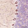 Anti-non-Muscle Myosin IIB / MYH10 Rabbit pAb