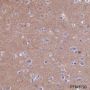Anti-Bcr Rabbit mAb