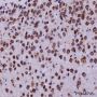 Anti-DDX3 Rabbit mAb