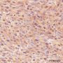 Anti-eIF4E Rabbit mAb