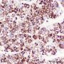 Anti-CPS1 Rabbit mAb