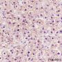 Anti-CPS1 Rabbit mAb