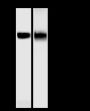 Anti-CD62L Rabbit mAb