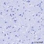 Anti-FGL1 Rabbit mAb