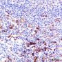 Anti-Fascin Rabbit mAb