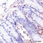 Anti-Fascin Rabbit mAb