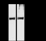Anti-beta IV Tubulin Rabbit mAb