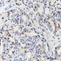 Anti-SLC45A3 Rabbit mAb