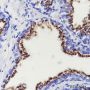 Anti-SLC45A3 Rabbit mAb