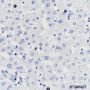 Anti-SLC45A3 Rabbit mAb