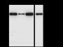 Anti-Hexokinase I Rabbit pAb