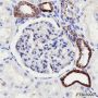 Anti-Hexokinase I Rabbit pAb