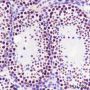 Anti-METTL3 Mouse mAb