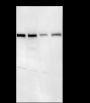 Anti-METTL3 Rabbit mAb