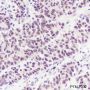 Anti-METTL3 Rabbit mAb