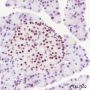 Anti-METTL3 Rabbit mAb