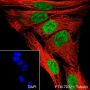 Anti-METTL3 Rabbit mAb