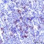 Anti-ACTH Rabbit mAb