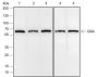 Anti-GBA Rabbit mAb