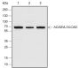 Anti-ACADVL/VLCAD Rabbit pAb